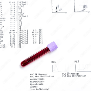 Comprehensive Metabolic Panel